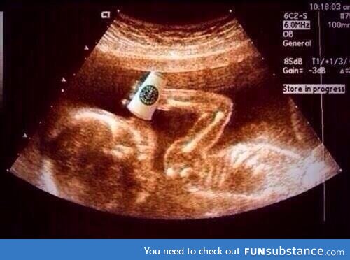 Congratulations! It's a white girl