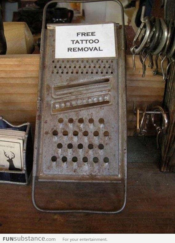 Tattoo Removal