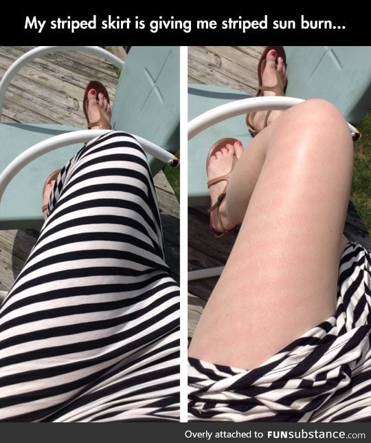 Striped legs