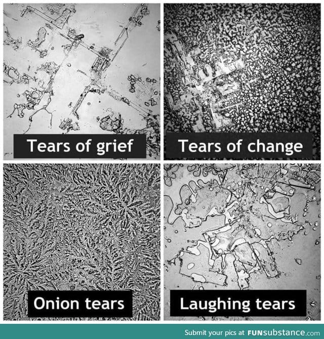 Different type of tears