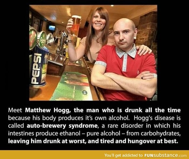 Matthew Hogg the guy who is always drunk due to auto-brewer syndrome