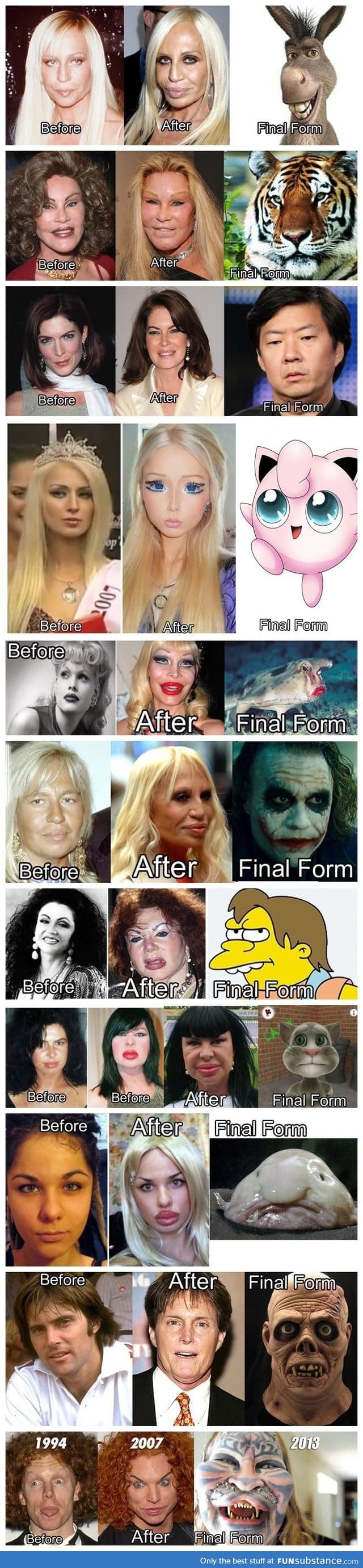 Plastic surgery fail