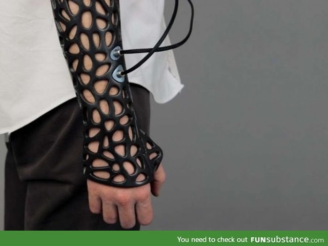 3D-Printed Cast Uses Ultrasound to Heal Bones 40% Faster