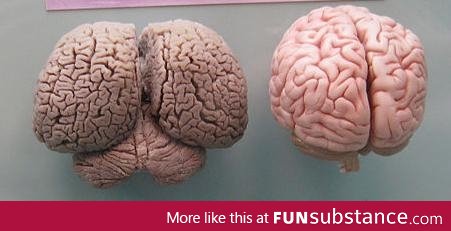 Dolphin brain vs Human brain