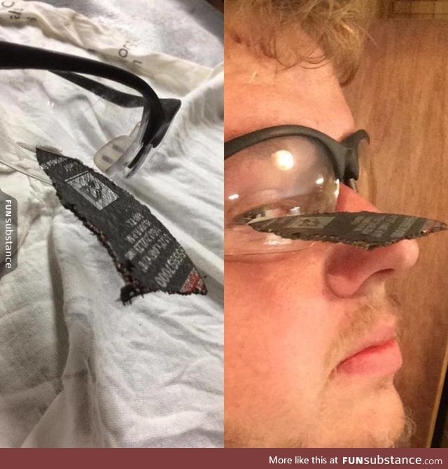 Safety specs saved this guy's eye from an exploding angle grinder disc