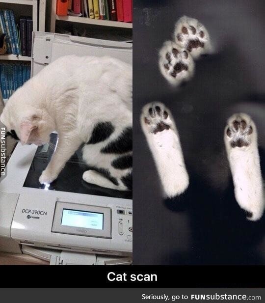 Cat scan