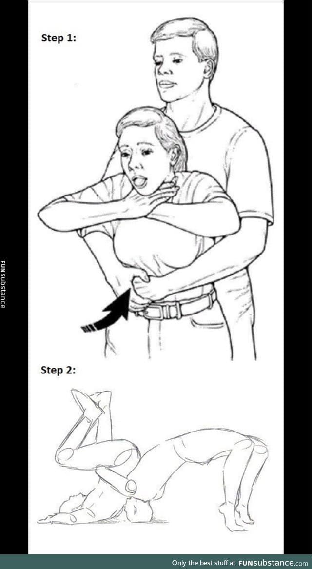 Heimlich maneuver