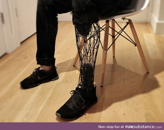 3D printed prosthetic