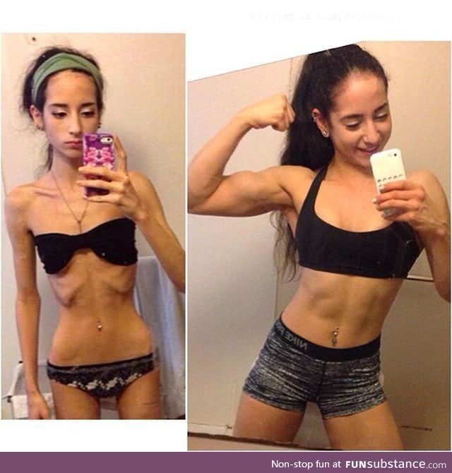 Sarah Ramadan, the girl who overcame anorexia