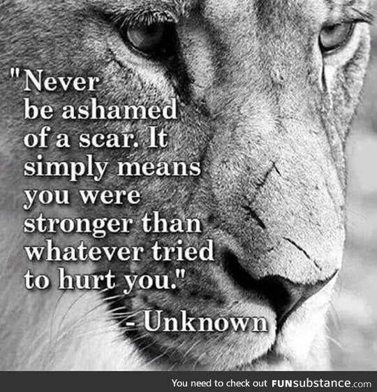 Ashamed of a scar