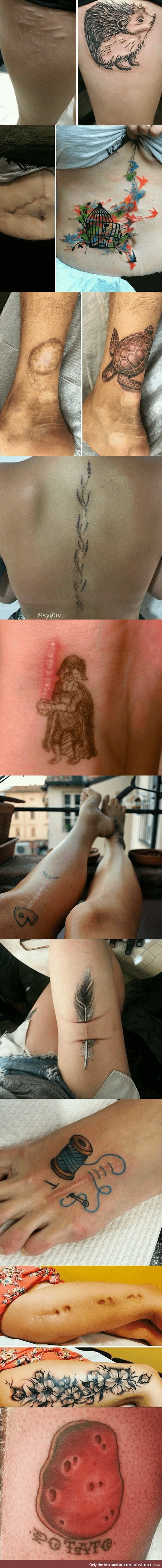 Amazing tattoos that turn scars into Works of Art