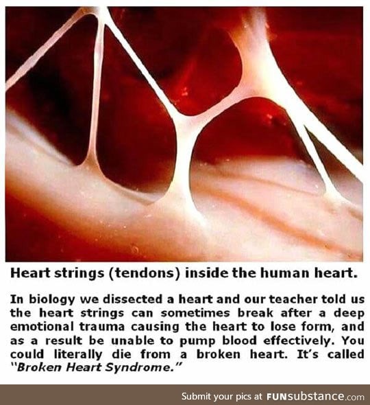 Broken heart syndrome