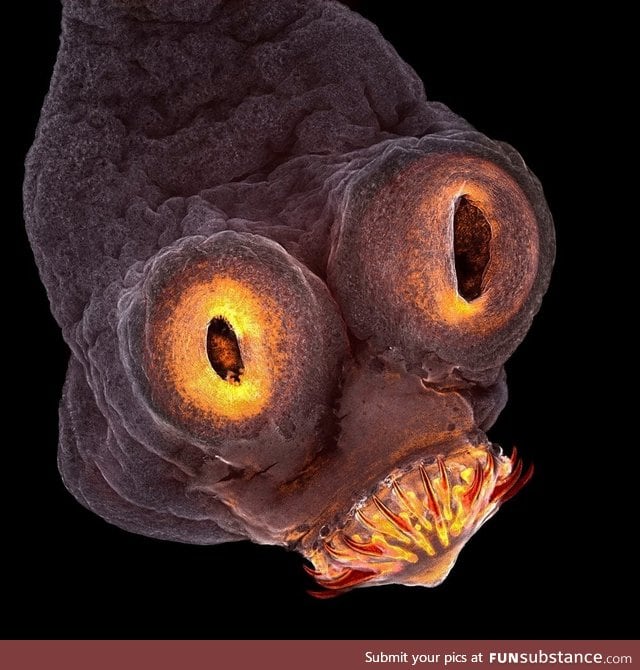 A micrograph of the head of a pork tapeworm