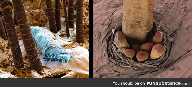 When feeling alone, remember that Demodex is always with you, in your eyelashes