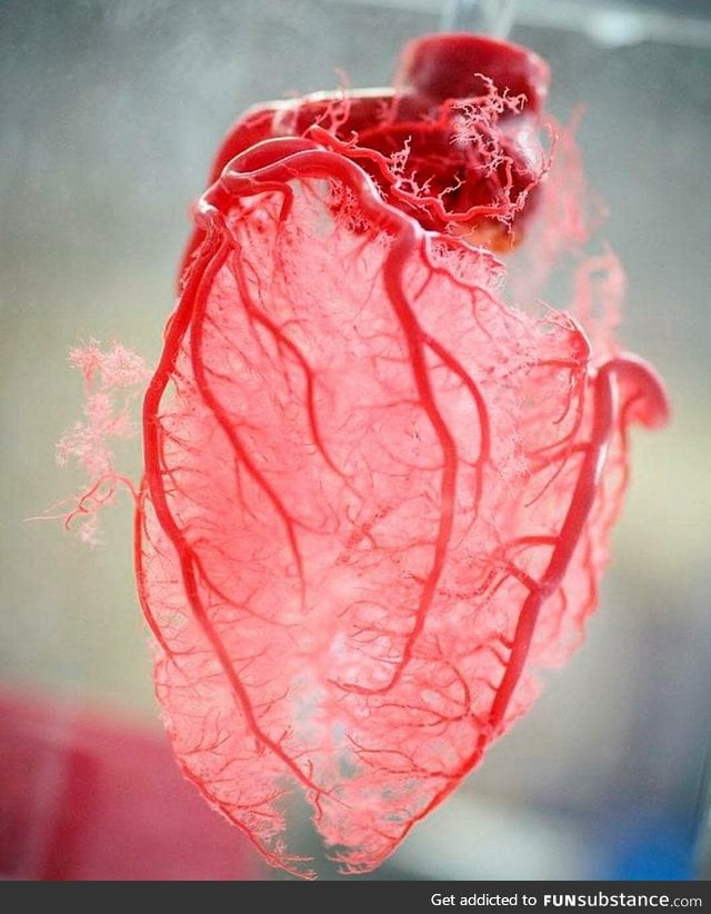 Resin cast of human heart blood vessels