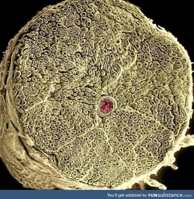 Human spinal nerve taken with electron micrograph