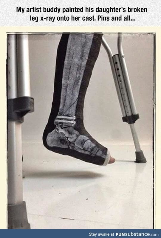 X-Ray cast