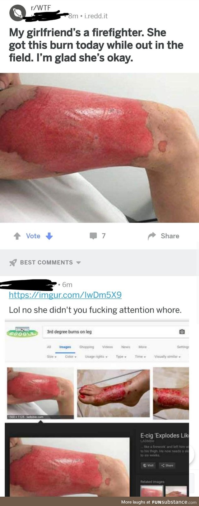 GF burn