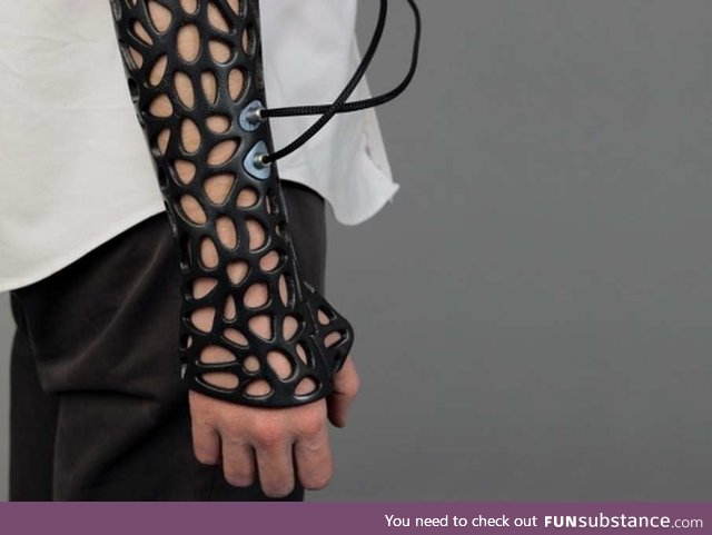 This 3D-printed cast uses ultrasound to heal broken bones 40% faster