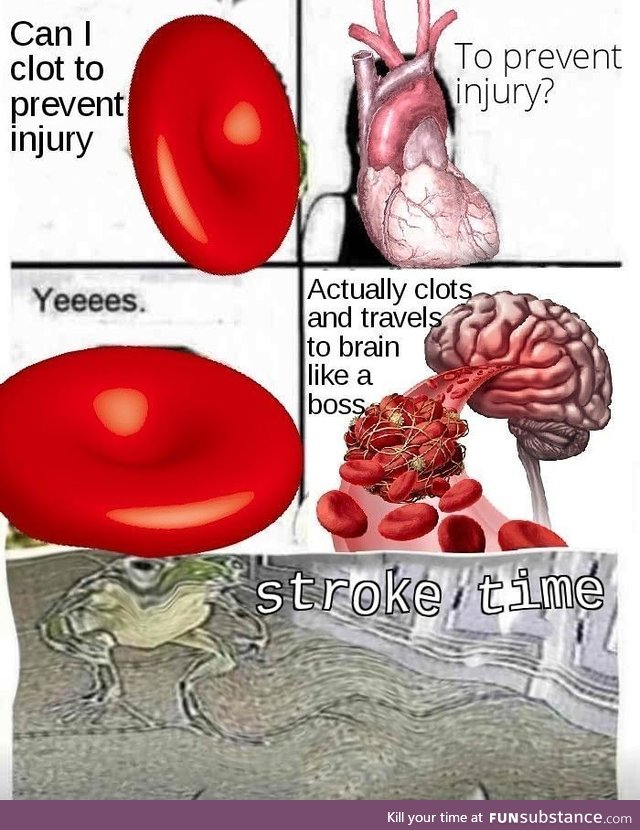 Stroke time