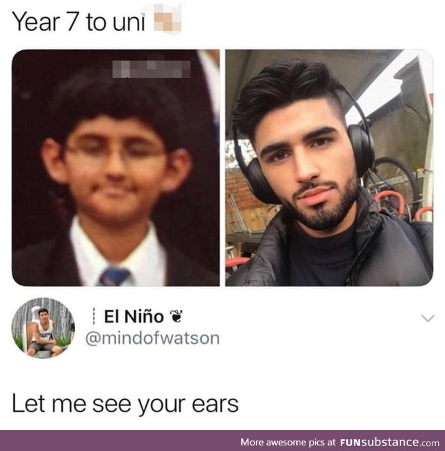 Those are his new ears