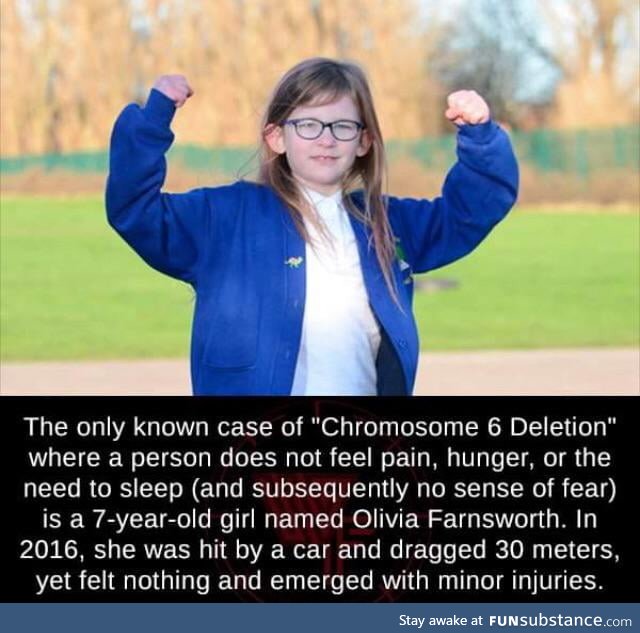 Only known case of Chromosome 6 Deletion