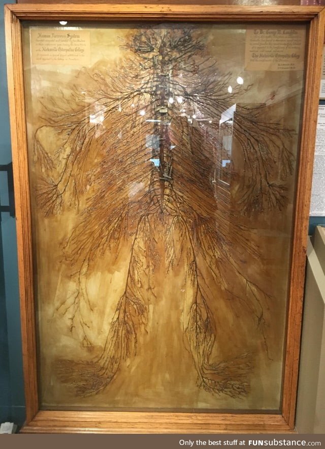 This is an intact human nervous system that was dissected by 2 medical students in 1925