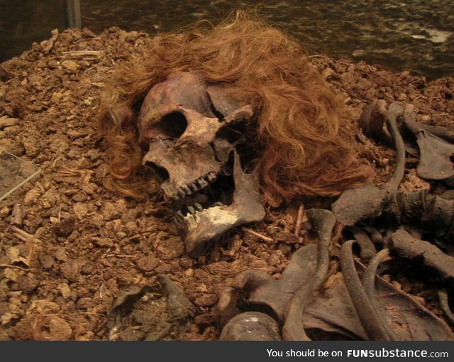 The "Bocksten man" bog body. The skeleton of a man who died around 700 years