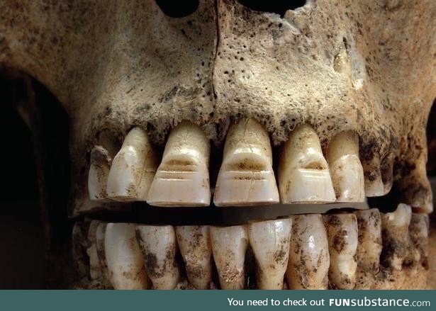 Vikings filed horizontal lines in to their teeth; No one person can say why this was