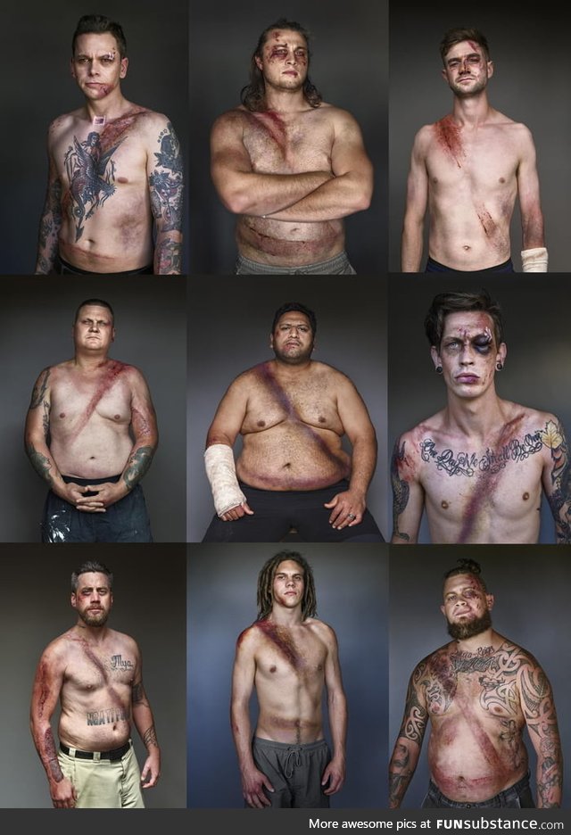 Car crash survivors showing the lifesaving effects of seatbelts