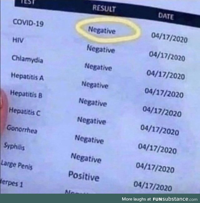 I got my covid-19 test back boys! I'm good