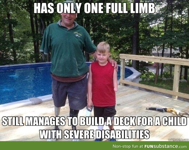 Good guy triple amputee