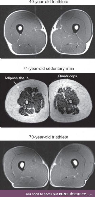 Adipose tissue is a social construct