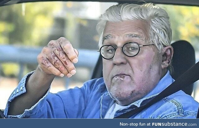 Jay Leno is back behind the wheel after being released from burns unit