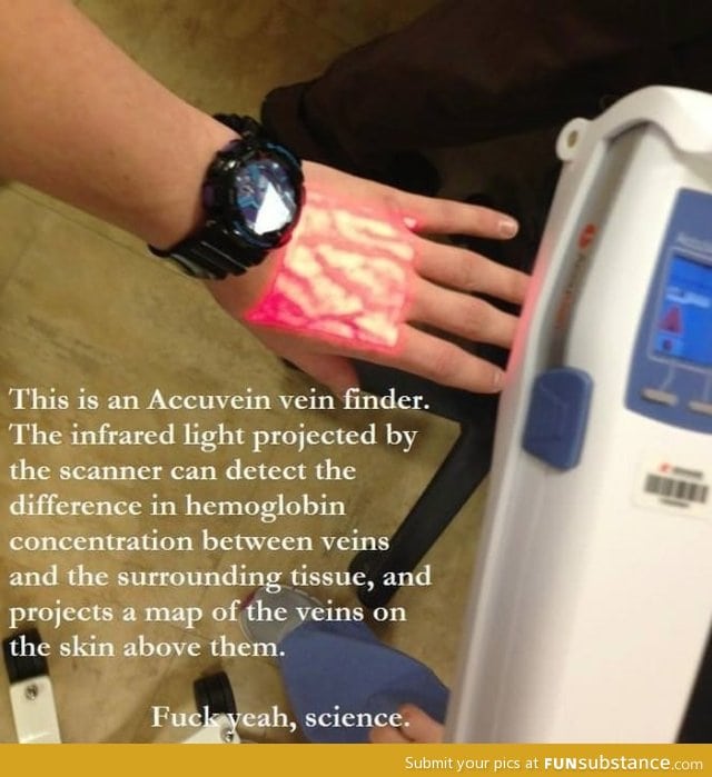 Accuvein vein finder