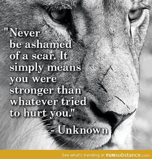 Never be ashamed of a scar