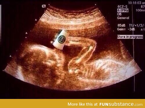 Congratulations! It's a white girl