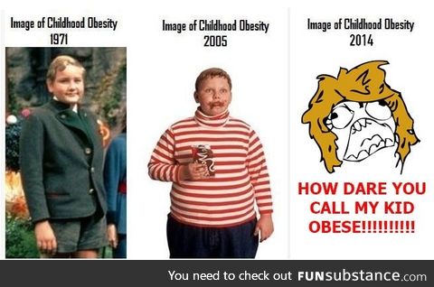 Progression of obesity