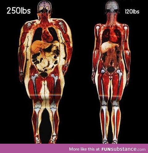 Body Scans: Fat vs Fit.