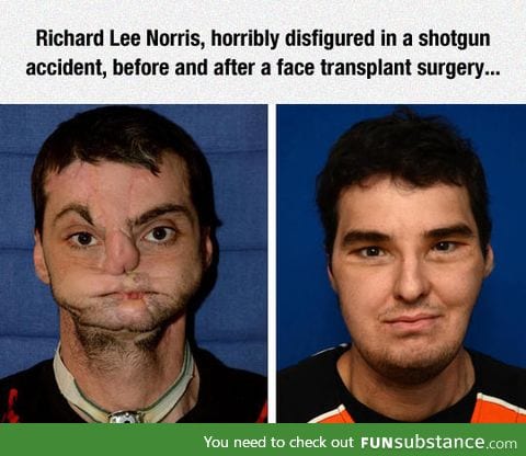 This surgeon did a fantastic job