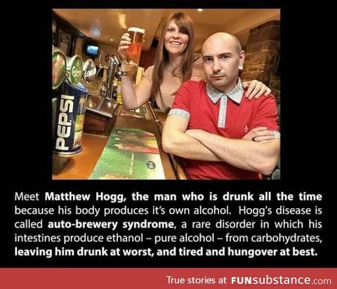 Matthew Hogg the guy who is always drunk due to auto-brewer syndrome