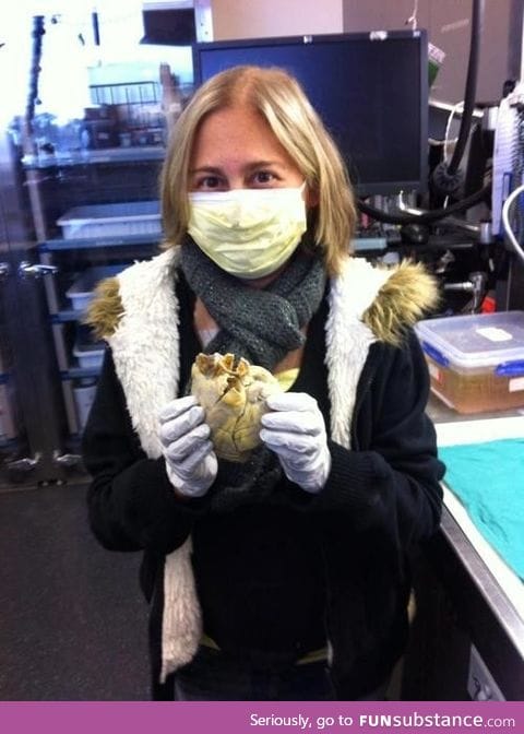 Penny, a transplant recipient, holding her Heart in her hands