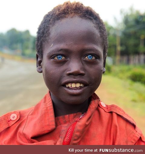 Ethiopian boy with blue eyes on the streets of Jinka (no photoshop)