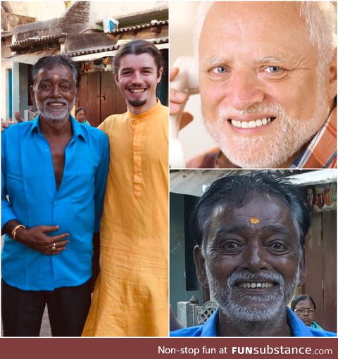 Met indian pain harold