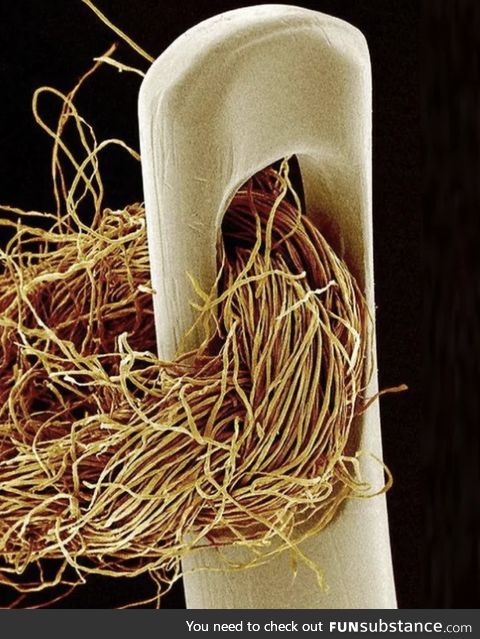 A needle and thread under an electron microscope