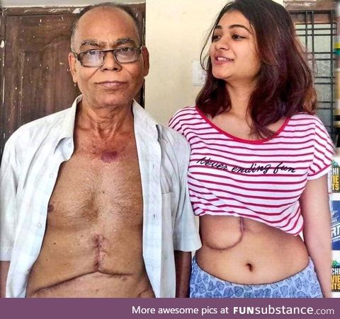 19 years old daughter donated her liver to Father