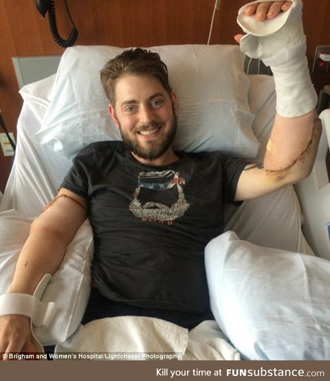 Former Marine receives double arm transplant after losing all four limbs to homemade bomb