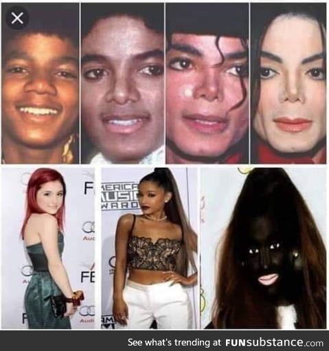 It's reverse vitiligo for her