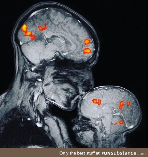 Magnetic resonance image showing a mother and child’s bond. The image is of