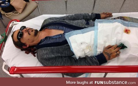 Johnny Depp lying in hospital after Amber Heard severed his finger (allegedly)